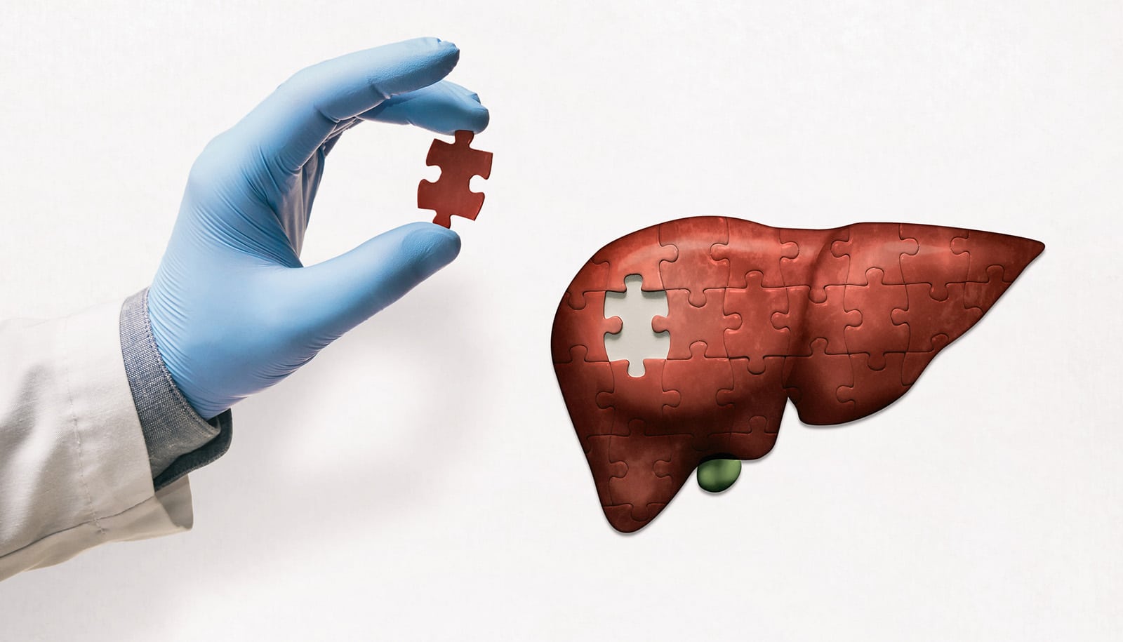 Liver Transplantation